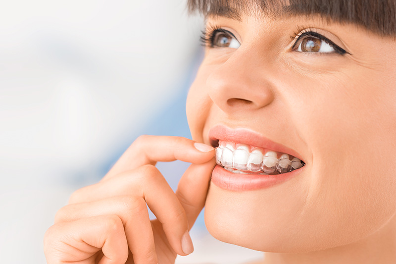 Invisalign in Elmhurst